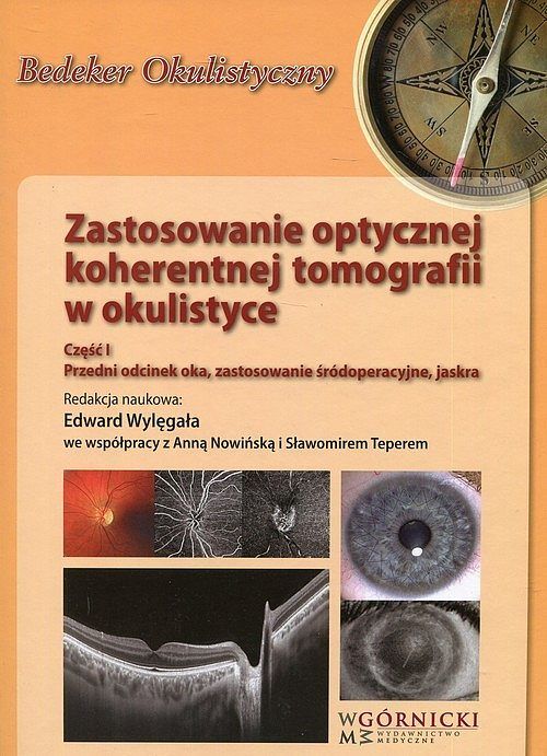 Zastosowanie optycznej koherentnej Tomografii w okulistyce. Część 1