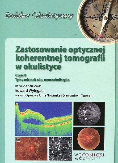 Zastosowanie optycznej koherentnej Tomografii w okulistyce. Część 2