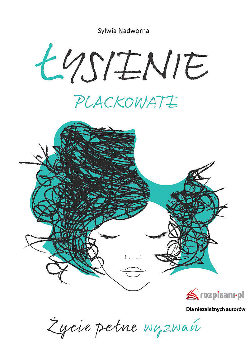 Łysienie plackowate