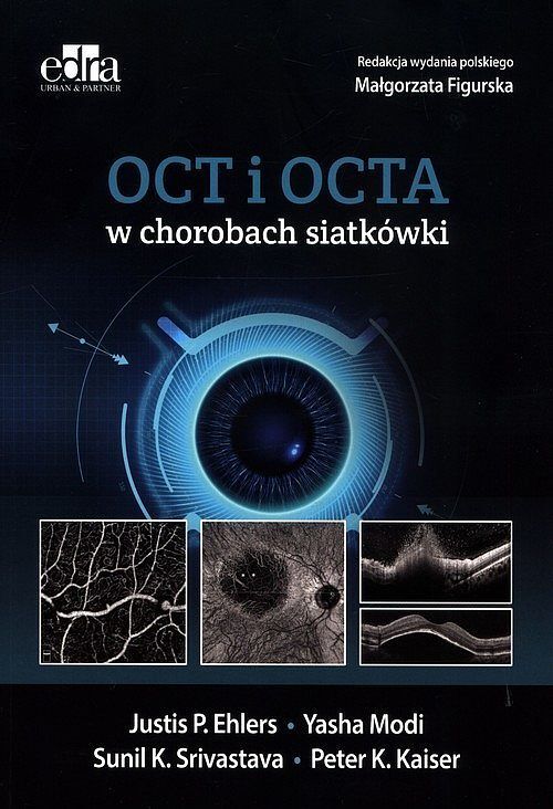 OCT i OCTA w chorobach siatkówki