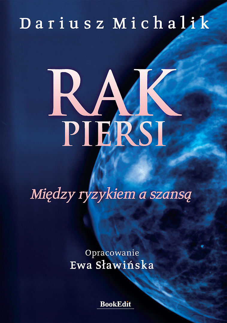 Rak piersi. Między ryzykiem a szansą
