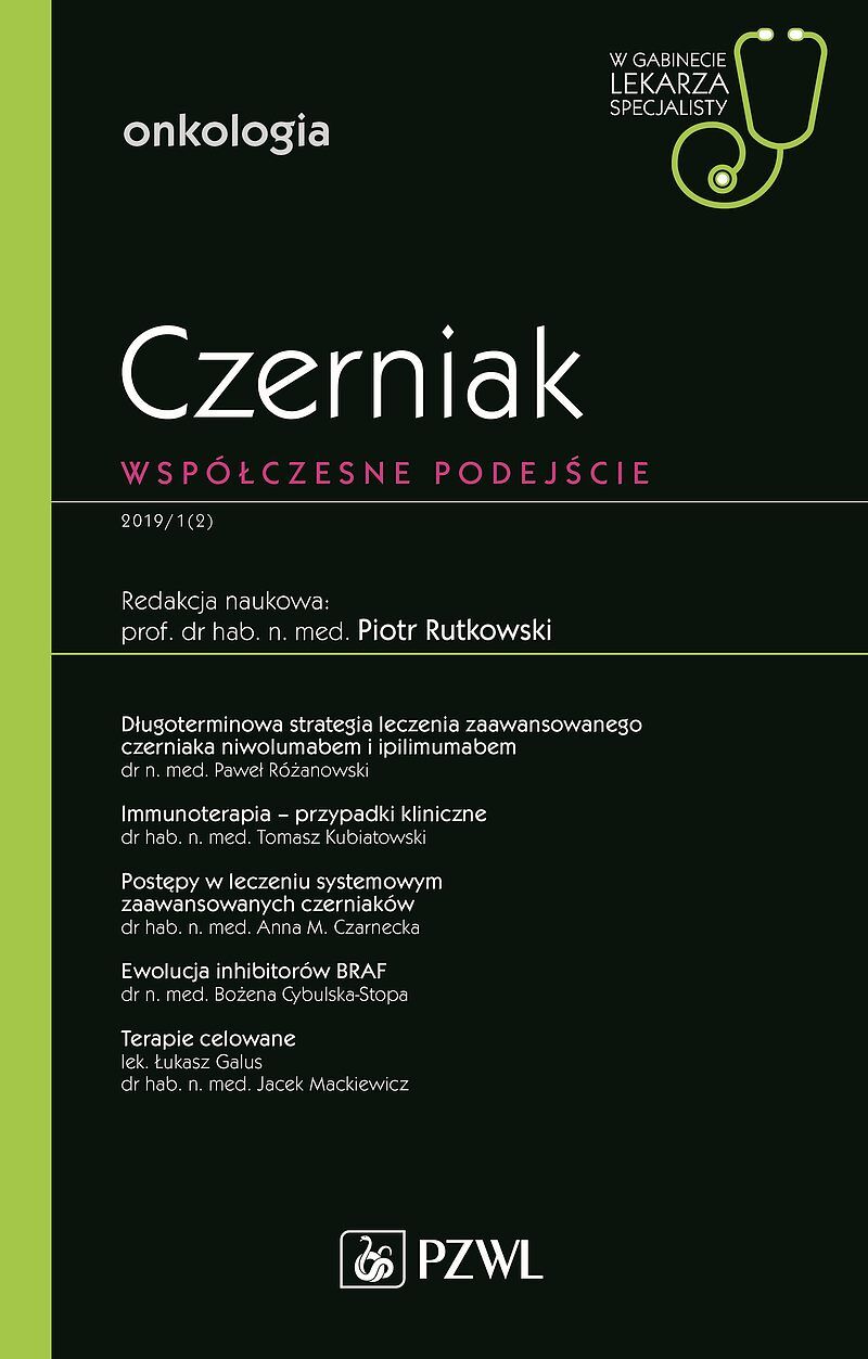 Czerniak. W gabinecie lekarza specjalisty.