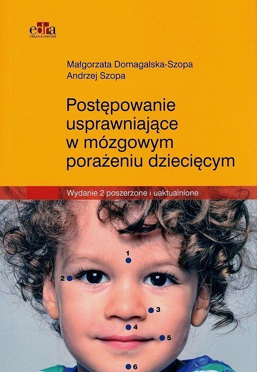Postępowanie usprawniające w mózgowym porażeniu dziecięcym