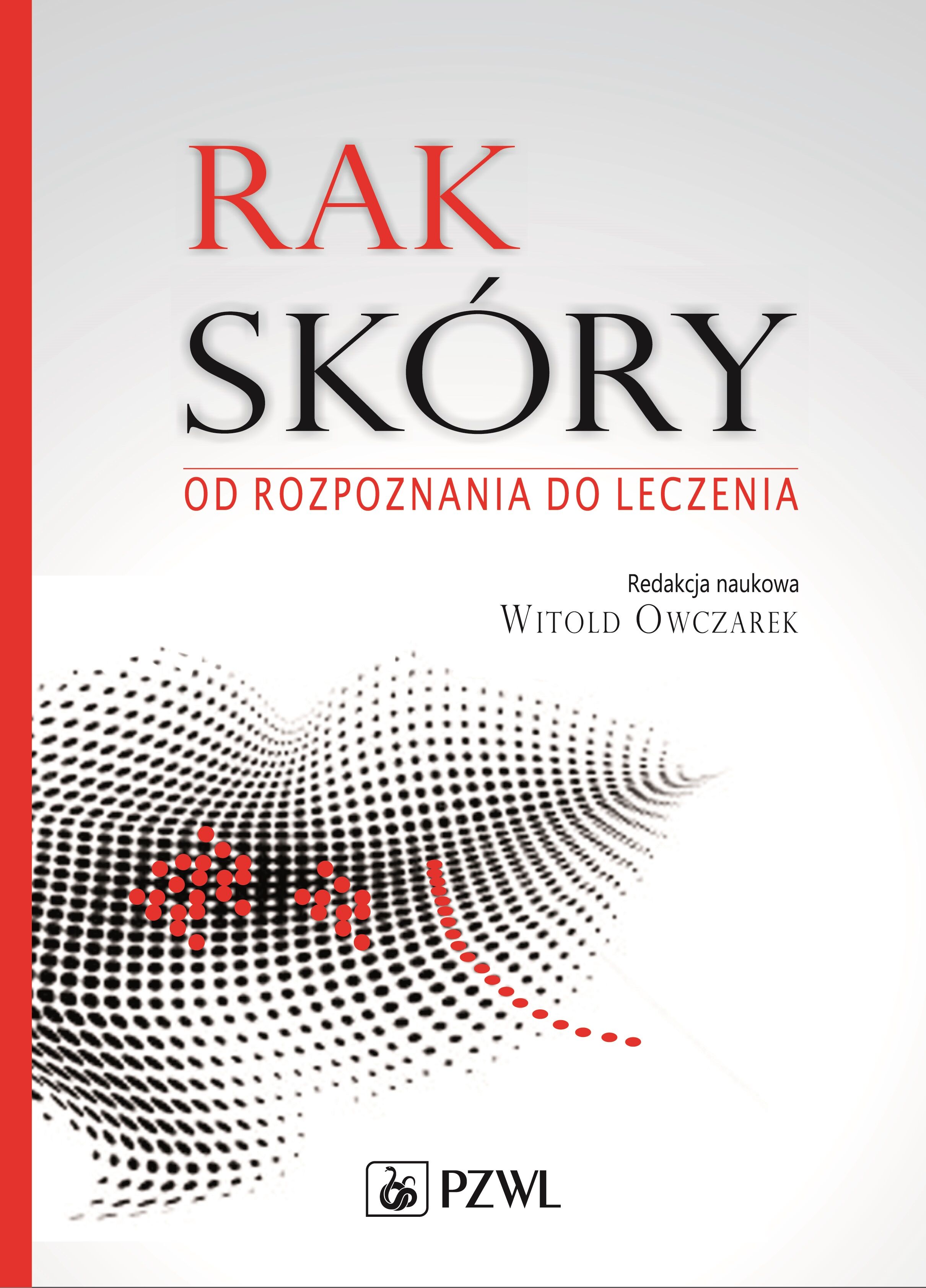 Rak skóry