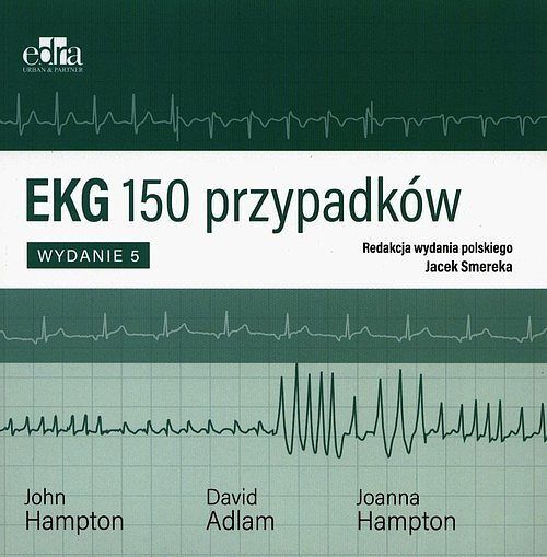EKG 150 przypadków