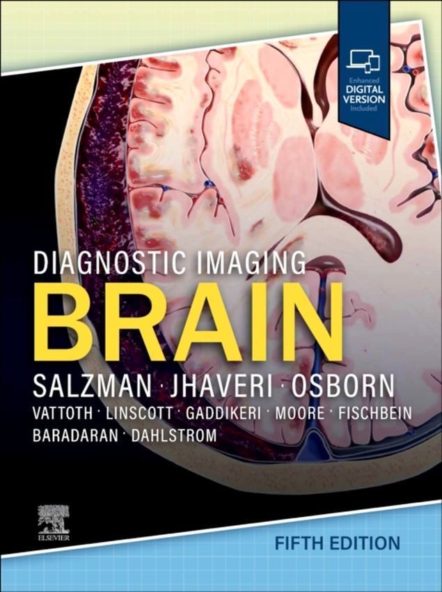 Diagnostic Imaging . Brain