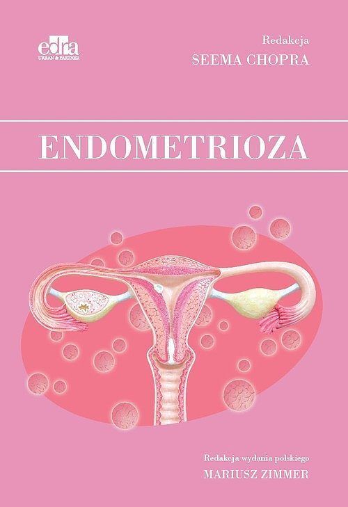 Endometrioza