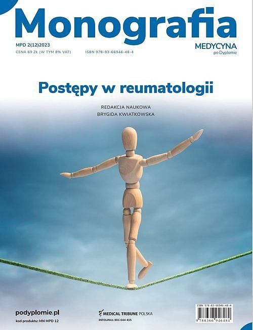 Postępy w reumatologii Monografia