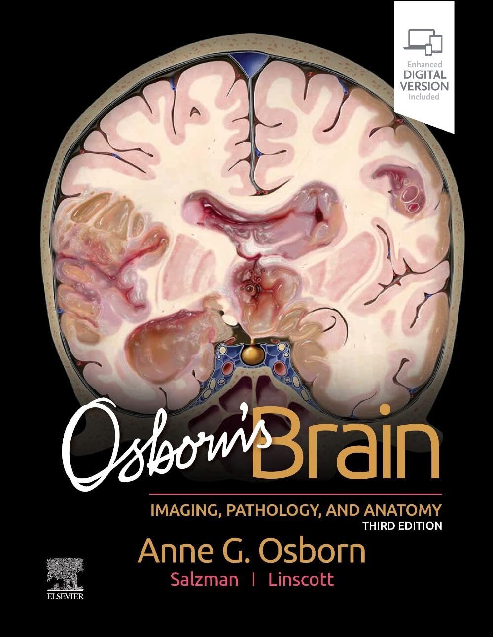 Osborn'S Brain