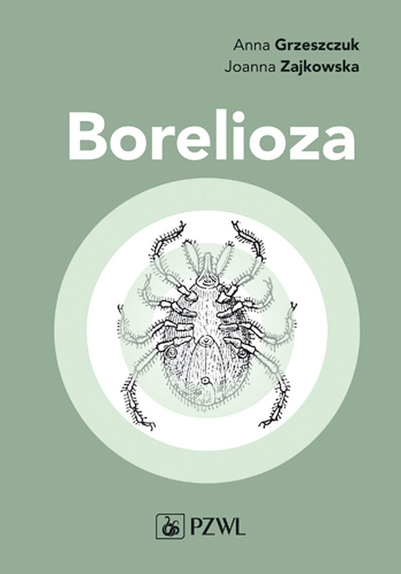 Borelioza w praktyce klinicznej