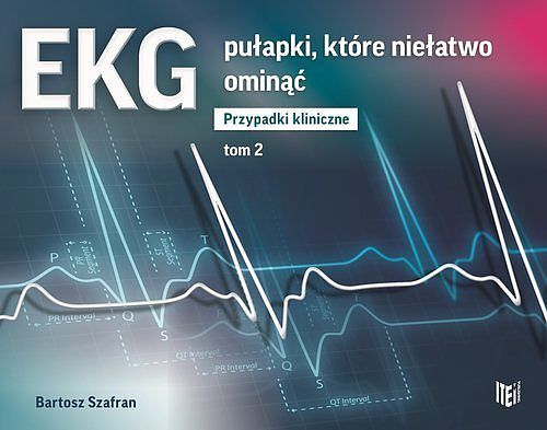 EKG pułapki. Tom 2