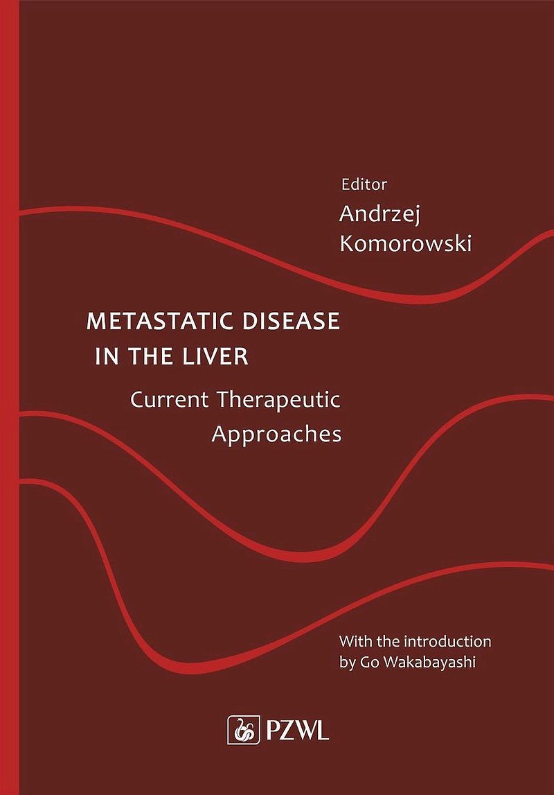 Metastatic Disease in the Liver – Current Therapeutic Approaches