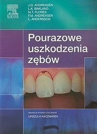 Pourazowe uszkodzenia zębów
