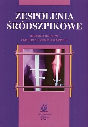 Zespolenia śródszpikowe