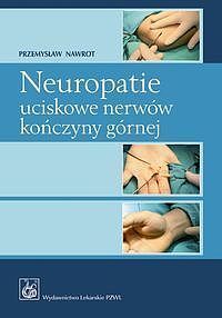 Neuropatie uciskowe nerwów kończyny górnej