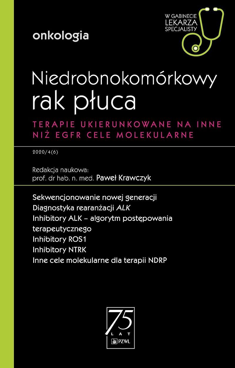 Niedrobnokomórkowy rak płuca. W gabinecie lekarza specjalisty.
