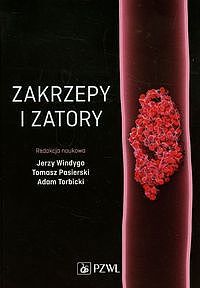 Zakrzepy i zatory