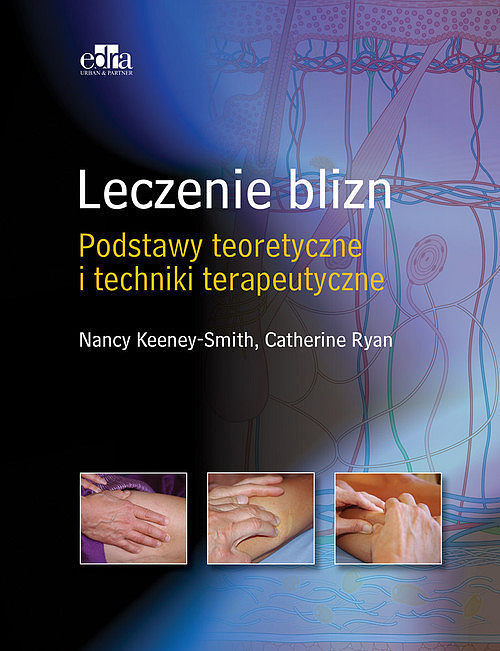 Leczenie blizn Podstawy teoretyczne i techniki terapeutyczne