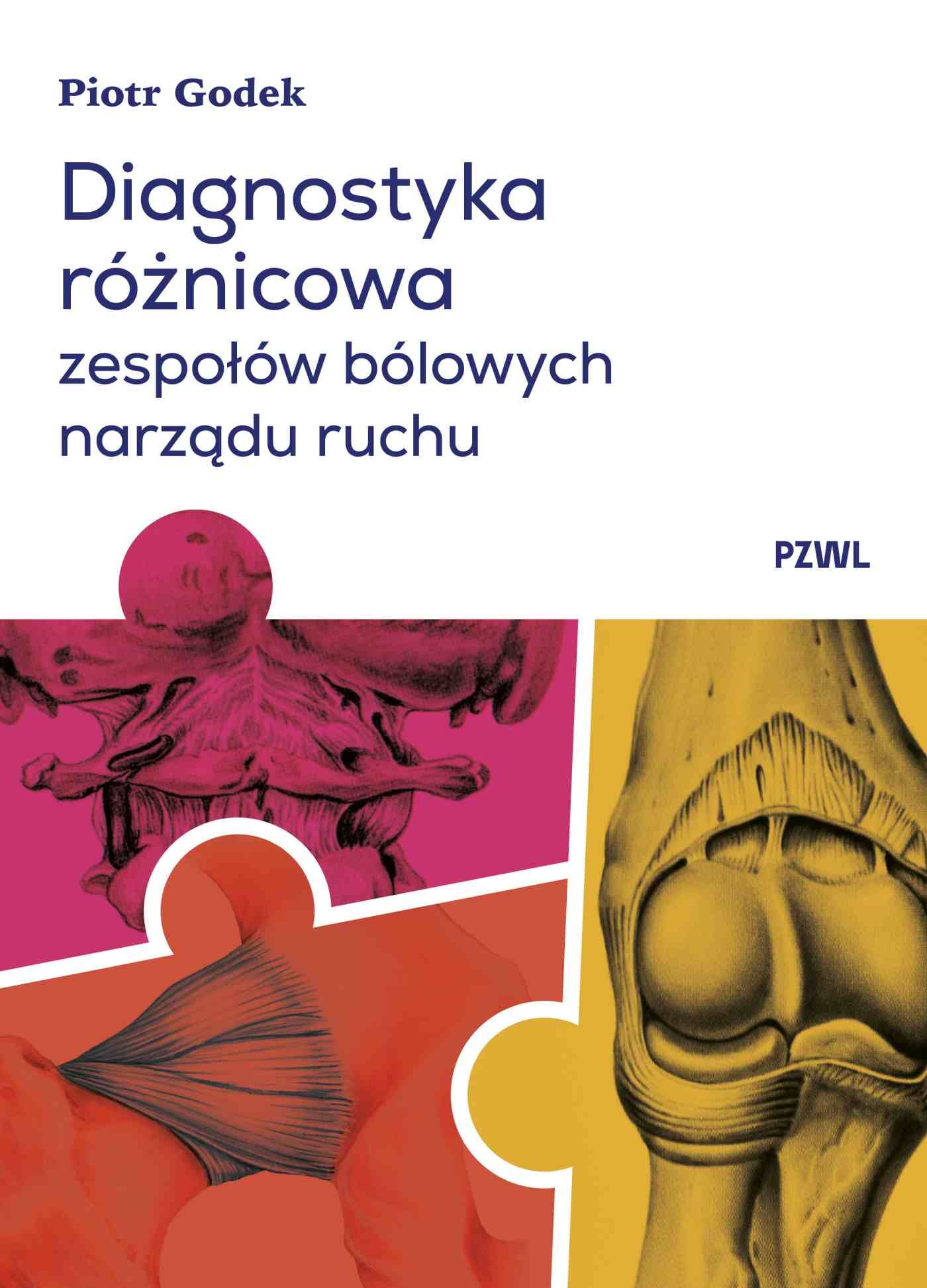 Diagnostyka różnicowa zespołów bólowych narządu ruchu