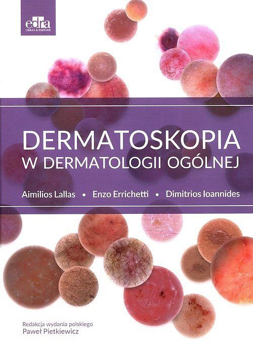 Dermatoskopia w dermatologii ogólnej