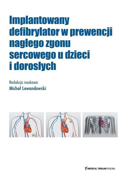 Implantowany defibrylator w prewencji nagłego zgonu sercowego u dzieci i dorosłych