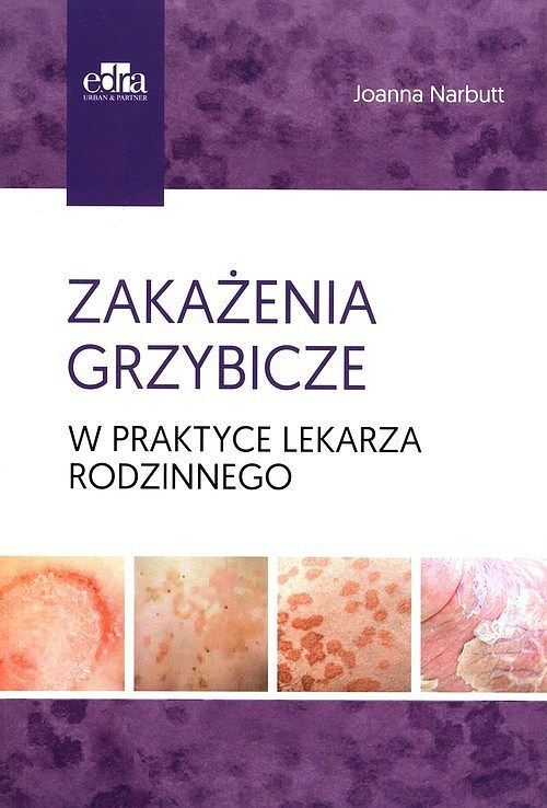 Zakażenia grzybicze w praktyce lekarza rodzinnego
