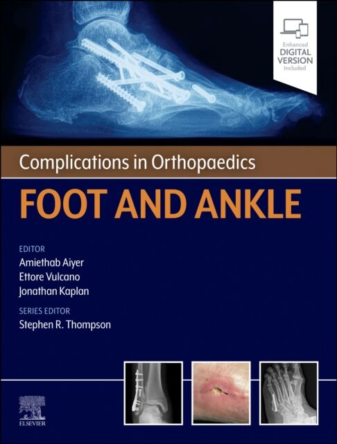 Complications in Orthopaedics. Foot and Ankle