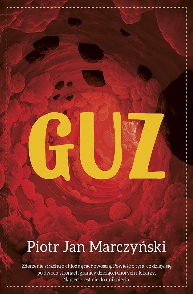 Guz