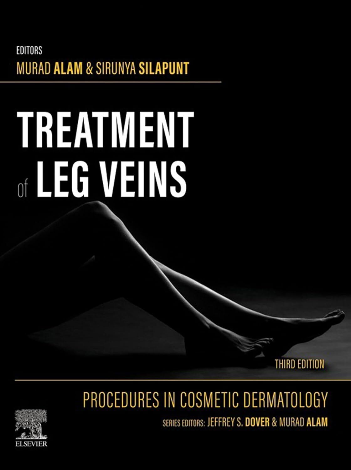Treatment of Leg Veins