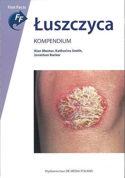 Łuszczyca