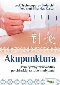 Akupunktura