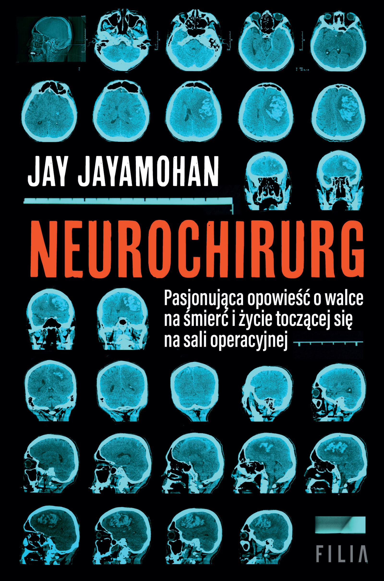 Neurochirurg