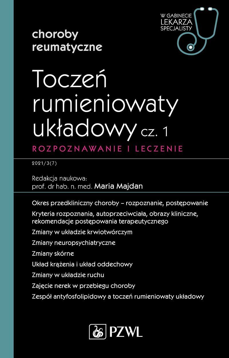 Toczeń rumieniowaty układowy, cz. 1. Rozpoznawanie i leczenie
