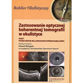 Zastosowanie optycznej koherentnej Tomografii w okulistyce. Część 1