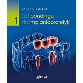 Od bondingu do implantoprotetyki. Cz. I