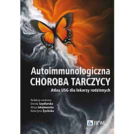Autoimmunologiczna choroba tarczycy
