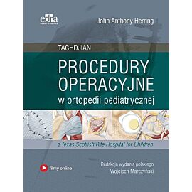 Procedury operacyjne w ortopedii pediatrycznej. Tachdjian
