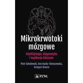 Mikrokrwotoki mózgowe