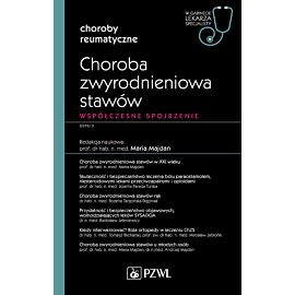 Choroba zwyrodnieniowa stawów. W gabinecie lekarza specjalisty.