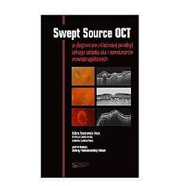 Swept Source OCT