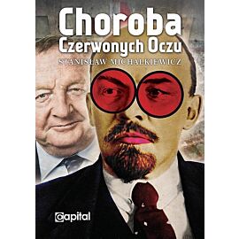 Choroba czerwonych oczu