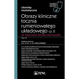 Obrazy kliniczne tocznia rumieniowatego układowego, cz. 2. Na podstawie opisów przypadków