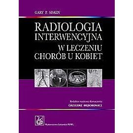 Radiologia interwencyjna w leczeniu chorób u kobiet