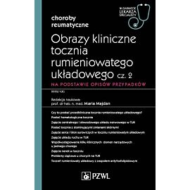 Obrazy kliniczne tocznia rumieniowatego układowego, cz. 2. Na podstawie opisów przypadków