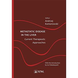 Metastatic Disease in the Liver – Current Therapeutic Approaches