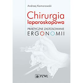 Chirurgia laparoskopowa.