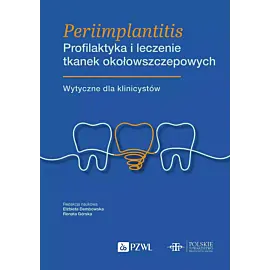 Periimplantitis. Profilaktyka i leczenie tkanek okołowszczepowych
