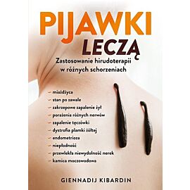 Pijawki leczą