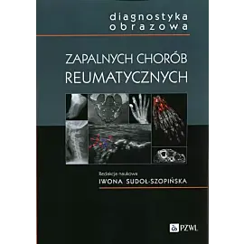Diagnostyka obrazowa zapalnych chorób reumatycznych
