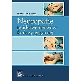 Neuropatie uciskowe nerwów kończyny górnej